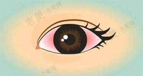 怎么去成都华厦眼科医院呢？