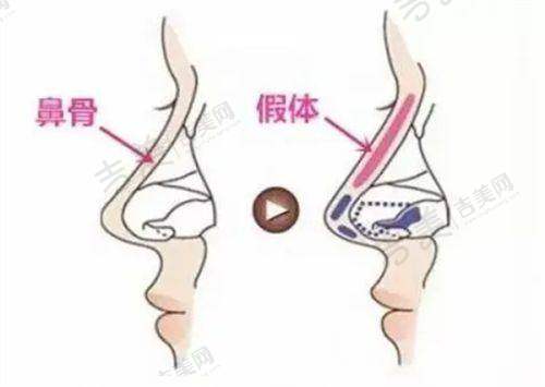 五、湘西赫美医疗美容怎么样之医生团队实力