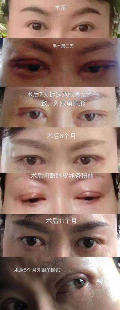 赤峰丽都整形医院怎么样，口碑评价如何？