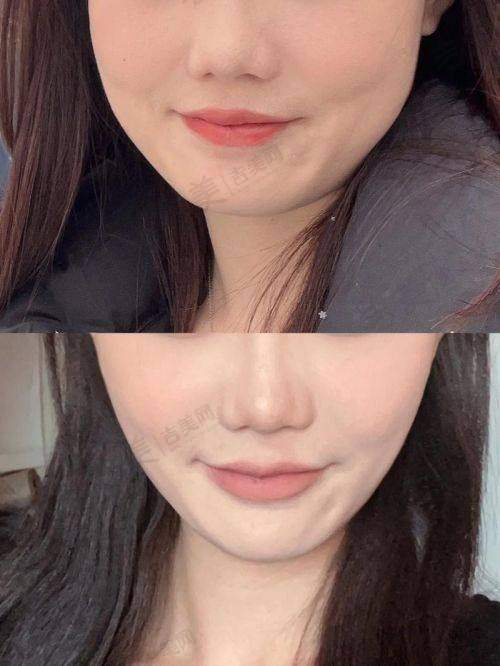 付德刚医生的口碑评价及反馈内容