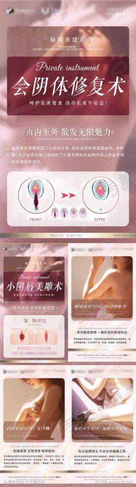 舒露英医生擅长的整形项目
