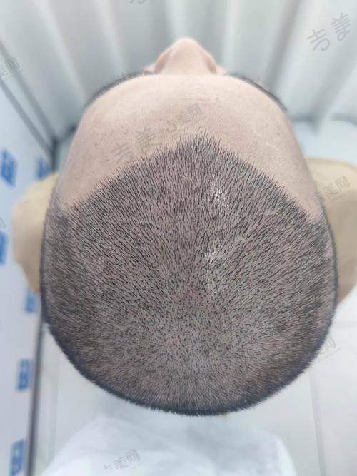 合肥丽都医疗美容门诊部项目特色