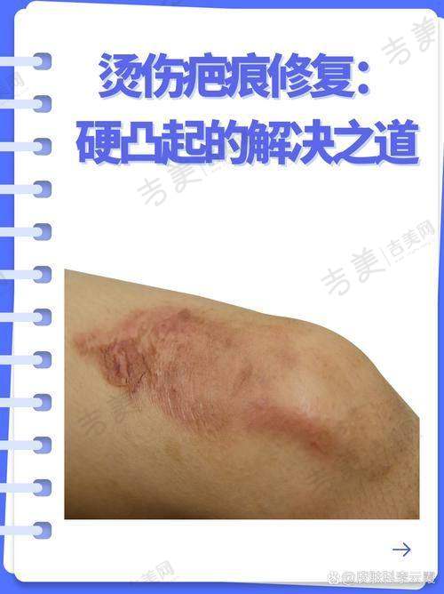 赤峰丽都整形医院项目特色