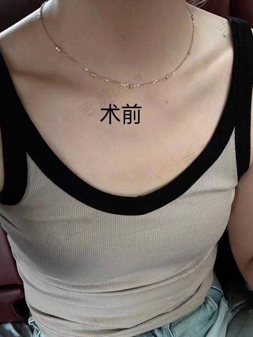 彭晶医生的技术优势亮点
