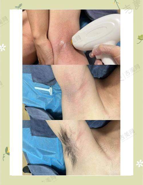 蒙自丽都医疗美容门诊部价格表