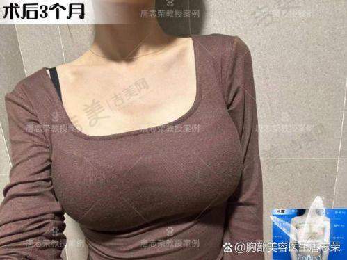 张燕雄医生的技术优势