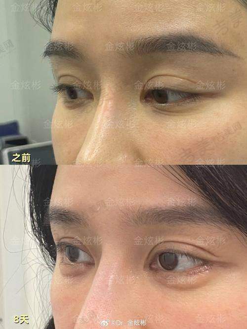 葛志鑫医生的技术优势亮点
