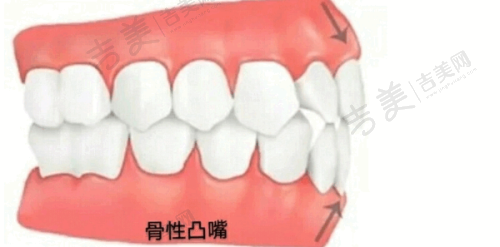 覃伟医生：长沙中诺口腔医院牙齿矫正执医荣誉