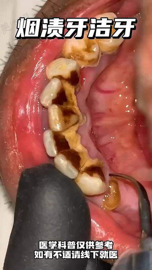 西宁中诺口腔门诊部口碑好不好?附真实患者口碑评价