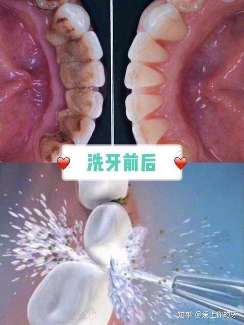枣庄中诺牙博士口腔门诊部价格表