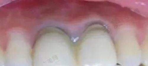 鄂尔多斯中诺口腔门诊部怎么样,口碑评价如何?