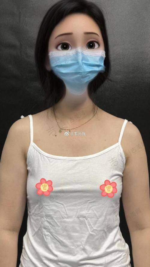温岭维多利亚整形纳米脂肪丰胸42000元起优势解读