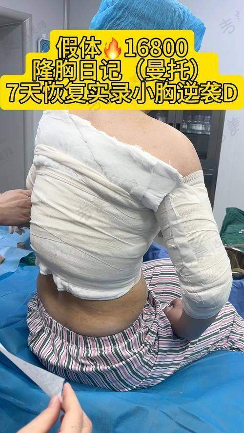 揭阳维多利亚整形玻尿酸注射丰胸23750元起医生专精解读