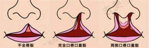周口市整形医院排名七强之雅美医疗美容诊所