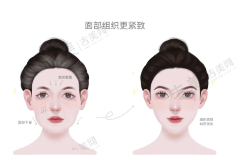 长春吸脂医院中妍和西之米哪家好：技术实力大比拼