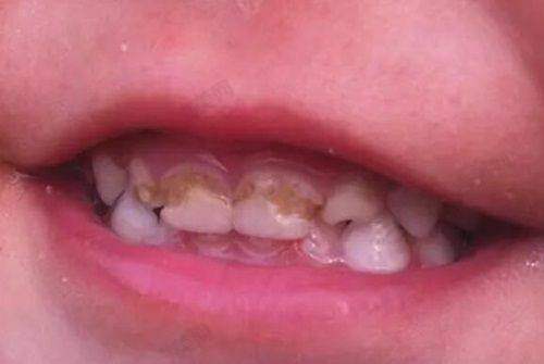 苏州美奥口腔医院口碑好不好？附真实患者口碑评价