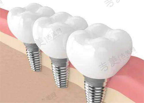 杭州美奥口腔(城星店)基本信息