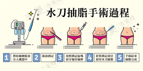 周口市整形医院排名七强之华美医疗美容门诊部