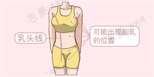 长春吸脂医院中妍和西之米哪家好：真人实例大揭秘