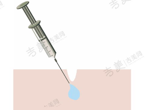 周口市整形医院排名七强之汇美医疗美容诊所