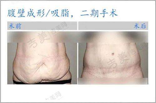 兰州崔大夫整形美容亮点是什么？崔大夫上榜兰州十大正规整形医院排行