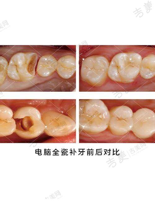 郑州美奥口腔医院口碑好不好？附真实患者口碑评价