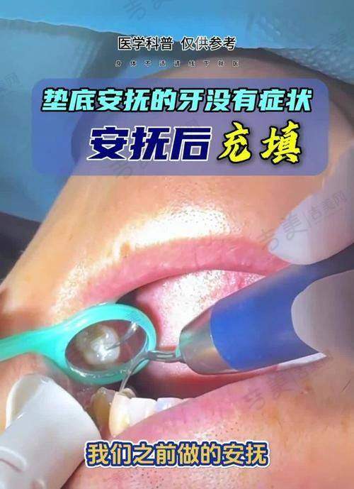 苏州科技城美奥口腔门诊部价格表