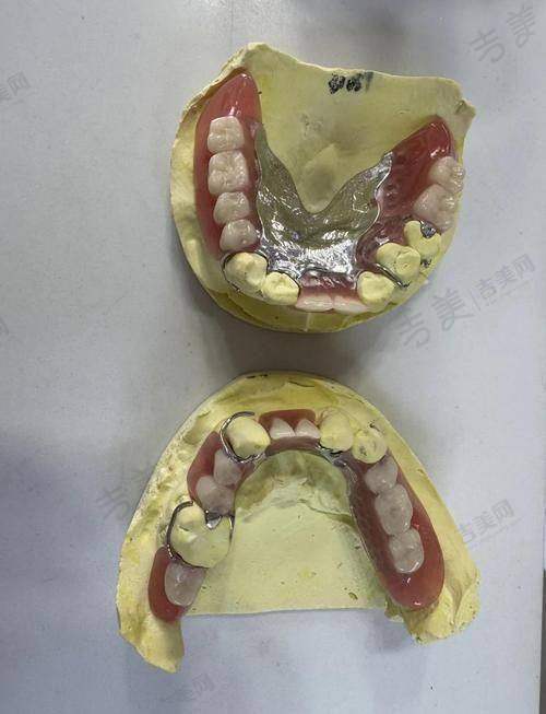 杭州美奥口腔（干江区分院）怎么样，口碑评价如何？