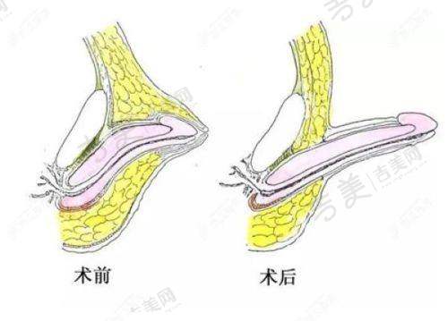 济南做激光祛斑好的医院之艺星的收费标准合理吗？