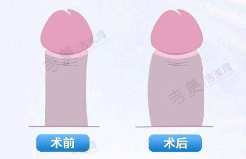 2025深圳皮肤科好的医院排名之综合实力强的医院