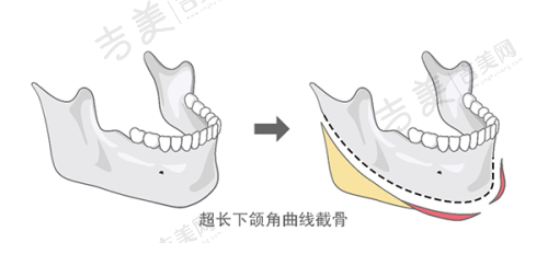 盘点南宁整形医院排行前十名的正规且性价比高的医院之南宁奢梵医疗美容门诊部