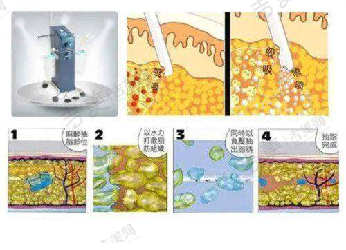 济南做激光祛斑好的医院之韩氏的服务质量怎样？