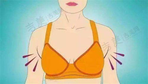 杭州格莱美隆胸：医院环境与服务体验