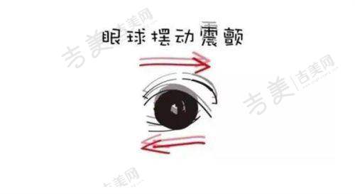 刘苏冰做近视手术怎么样：临床经验多