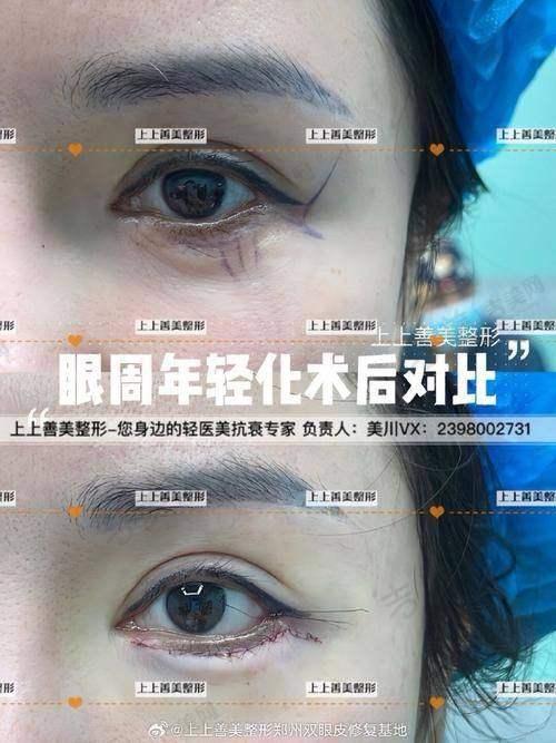 天津大港伊莱美医疗美容门诊部口碑好不好？附真实患者口碑评价