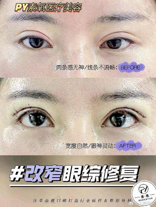 沈阳欧华医疗美容医院怎么样，口碑评价如何？
