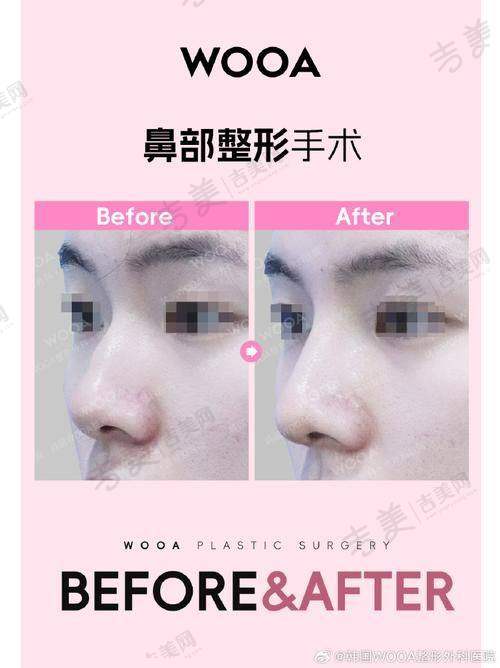 义乌连天美整形医院口碑好不好?附真实患者口碑评价