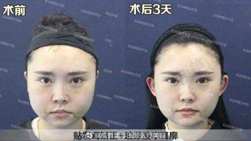 义乌连天美整形医院医生简介