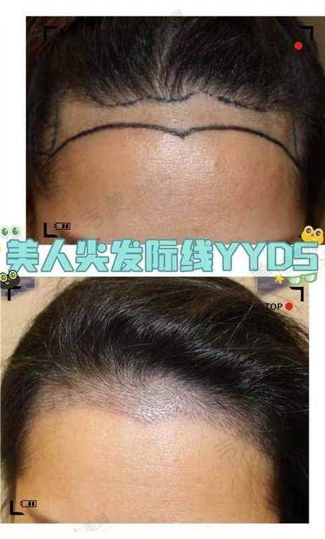 芜湖伊莱美整形医院医生简介