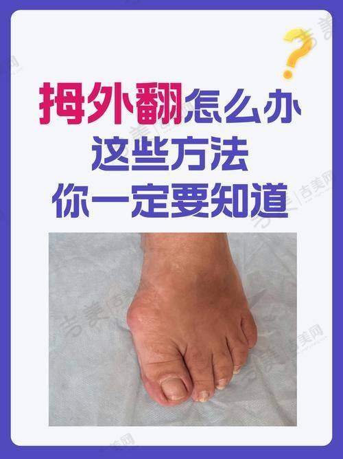 义乌连天美整形医院价格表