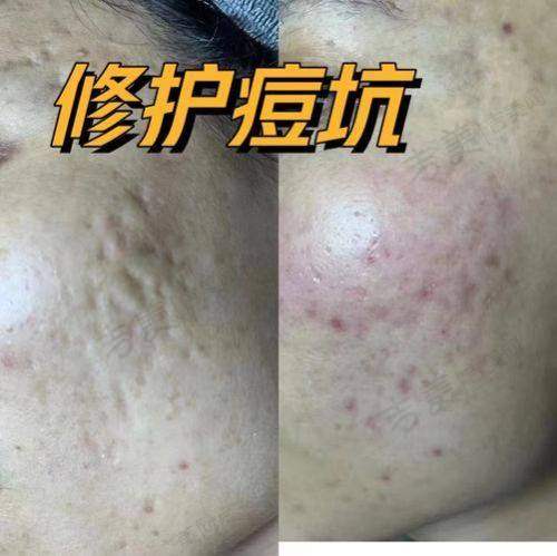 南京欧华整形医院怎么样，口碑评价如何？