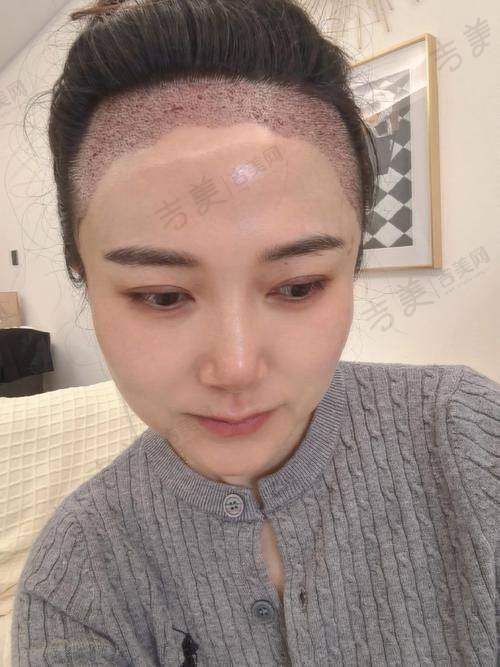 芜湖伊莱美整形医院项目特色