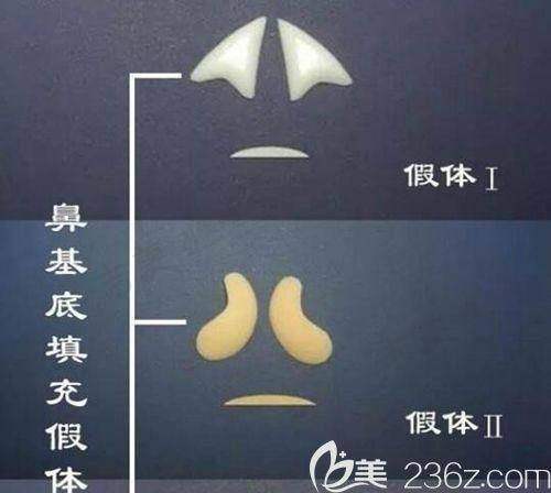 总结：假体隆鼻可以维持一辈子吗