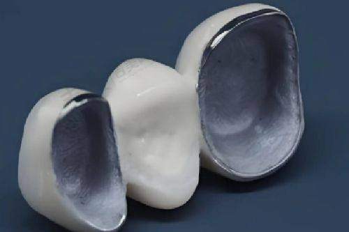 珠海同步齿科价格表分享一:牙齿清洁