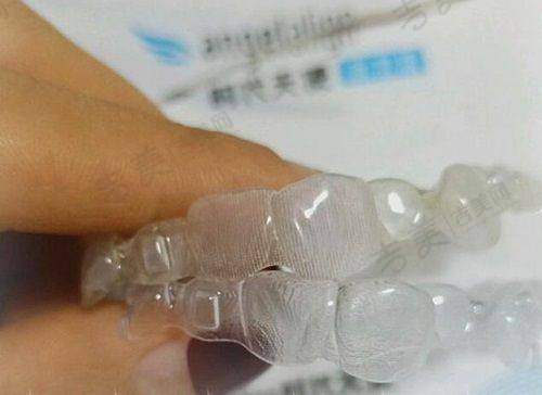 成都团圆口腔优势项目与口碑解读：种植牙项目怎么样？