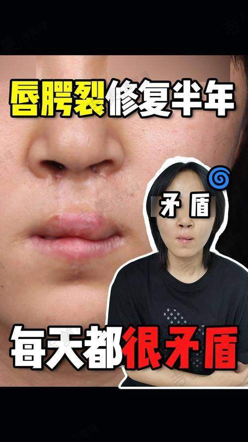 中山大学附属第一医院整形科耳再造收费价格有降价的可能吗？