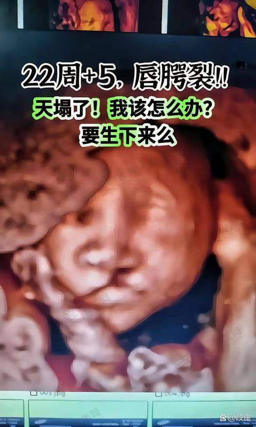 中山大学附属第一医院整形科耳再造收费价格受哪些因素影响？