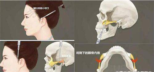 芜湖伊莱美整形正规靠谱及收费标准情况：和其他机构相比优势在哪？