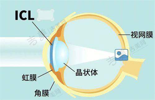 合肥东南眼科医院需要预约吗？特定医生之夏博医生预约方式