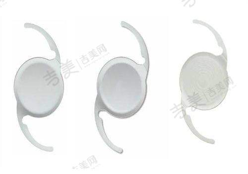 攀枝花五医院眼科飞秒近视手术费用和其他医院对比如何？